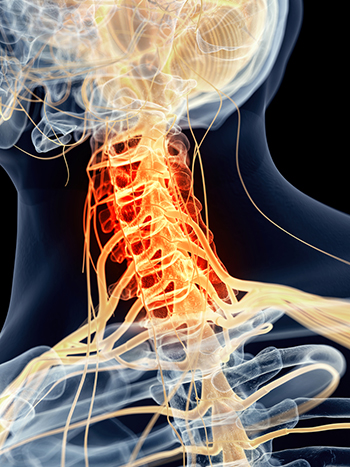 首の関節をポキポキ鳴らすと寿命が縮まる 骨の変形を招くリスク